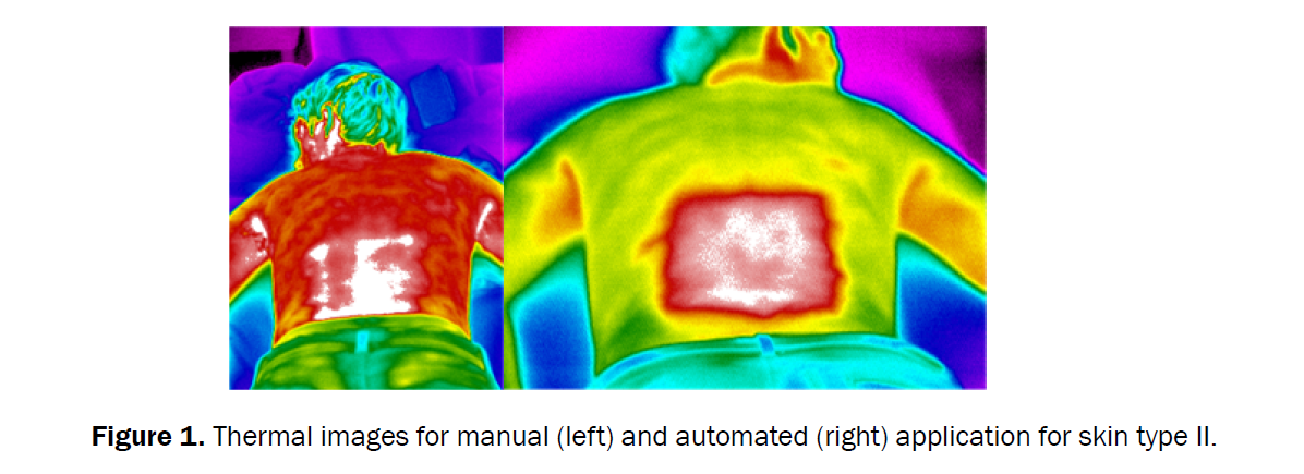 medical-health-sciences-thermal-images