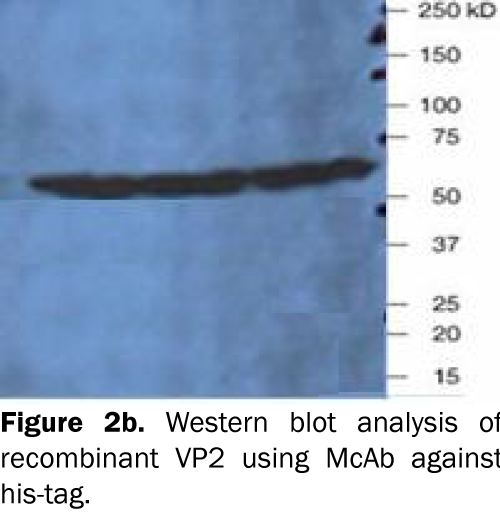 microbiology-and-biotechnology-Western-blot-analysis