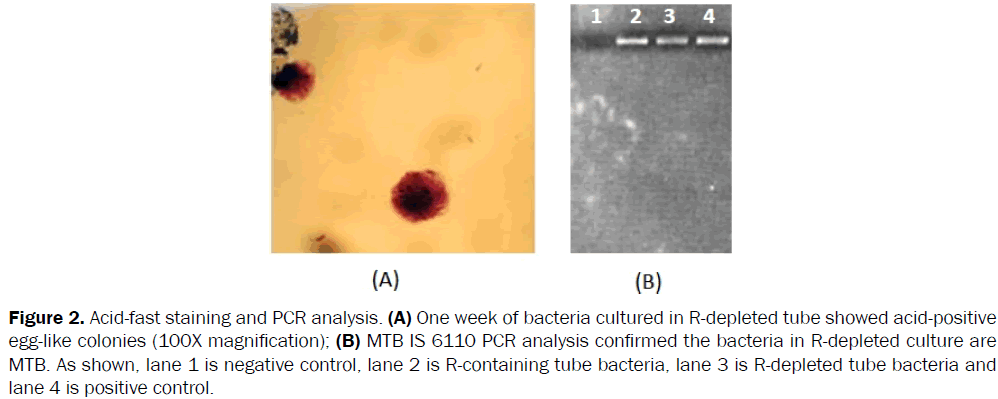 microbiology-biotechnology-Acid-fast-staining-bacteria