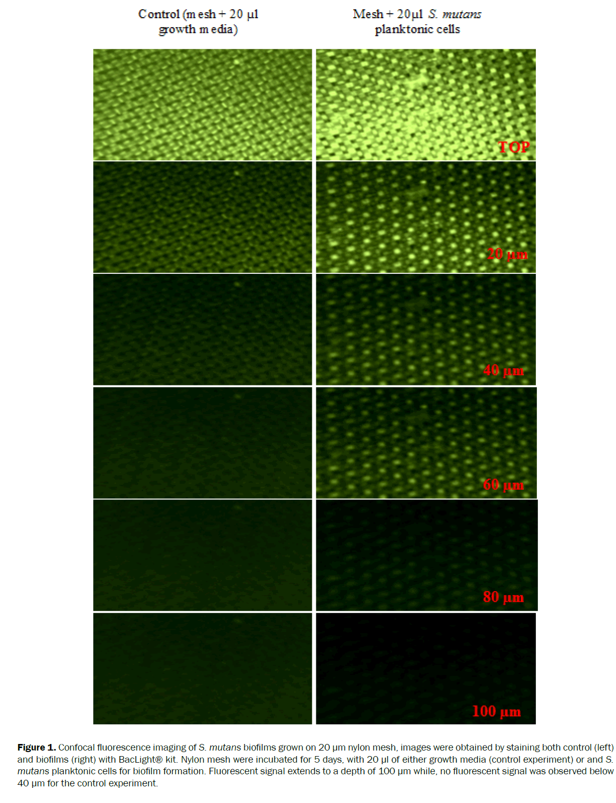 microbiology-biotechnology-Confocal-fluorescence