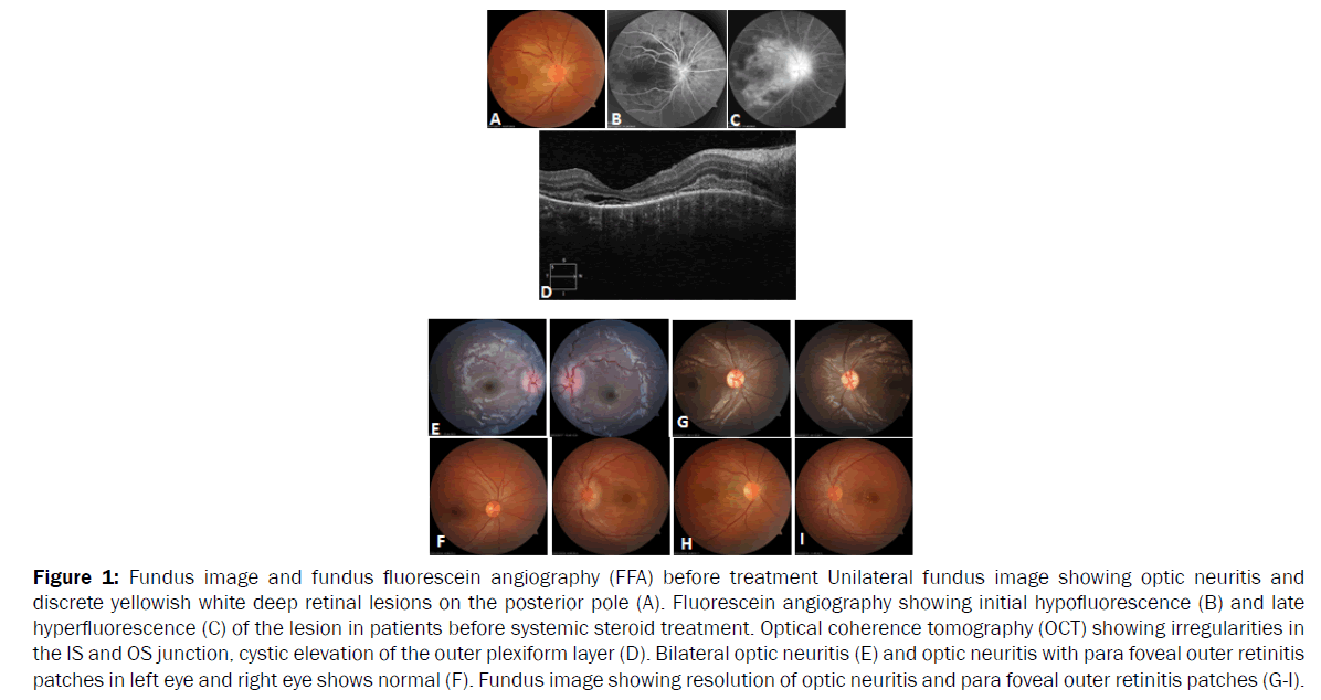 microbiology-biotechnology-Fundus-image