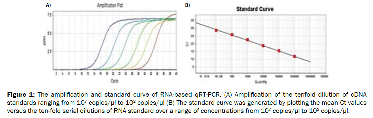 microbiology-biotechnology-RNA-based-qRT-PCR