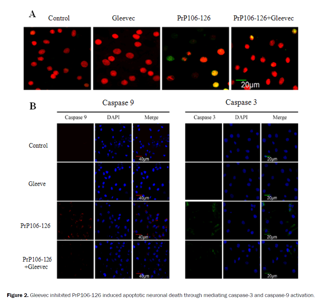 microbiology-biotechnology-apoptotic-neuronal