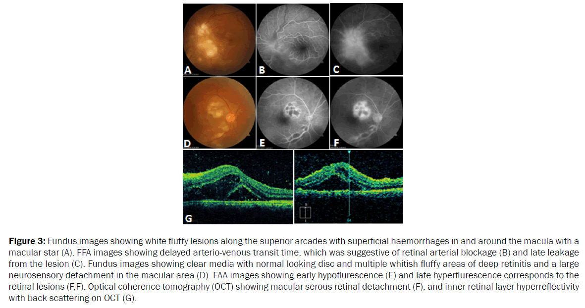 microbiology-biotechnology-fluffy-lesions