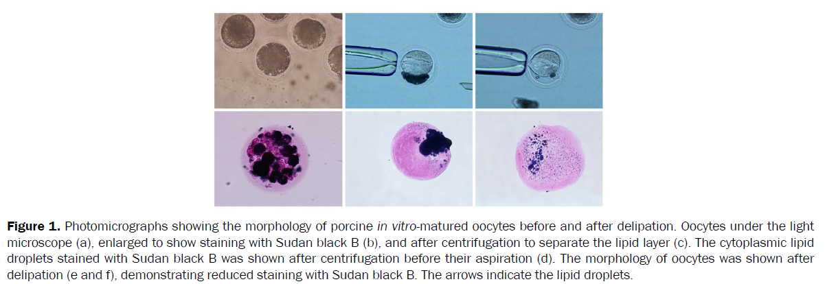 microbiology-biotechnology-in-vitro-matured-oocytes