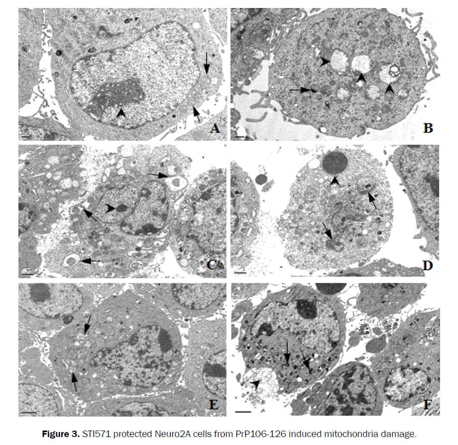 microbiology-biotechnology-mitochondria-damage