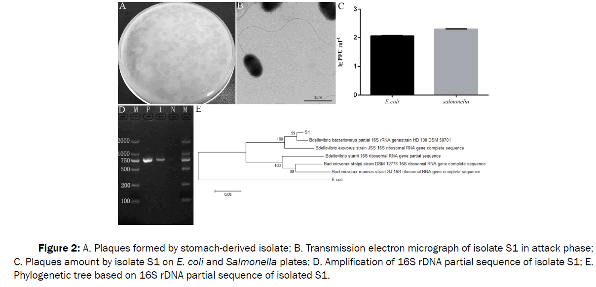 microbiology-electron-micrograph