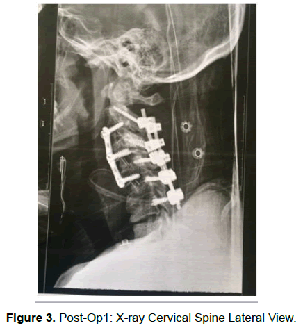 neuroscience-Spine-Cervical
