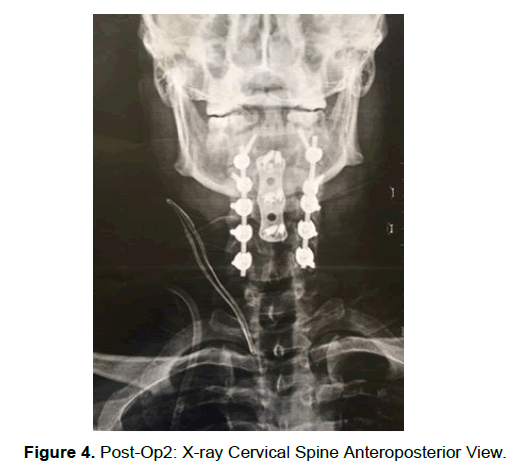 neuroscience-Spine-Post