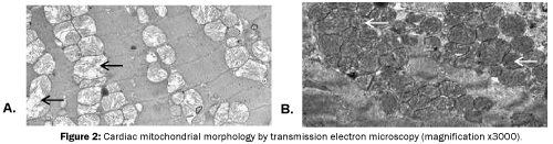 nursing-and-health-sciences-Cardiac-mitochondrial