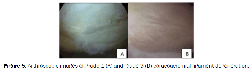 nursing-health-sciences-Arthroscopic-images