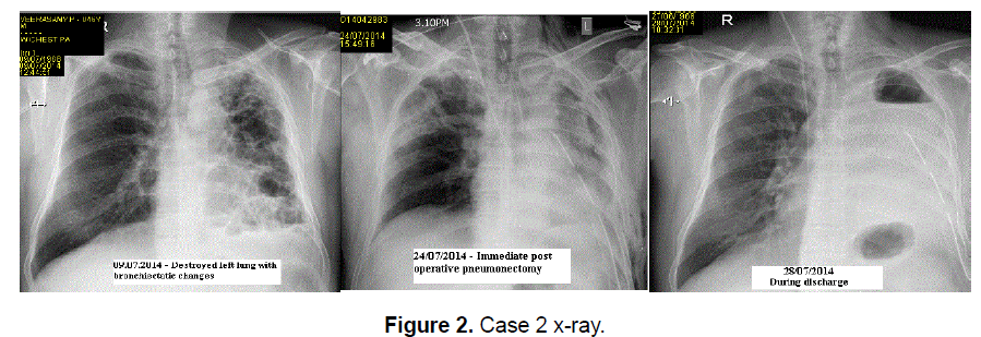 nursing-health-sciences-Case-2