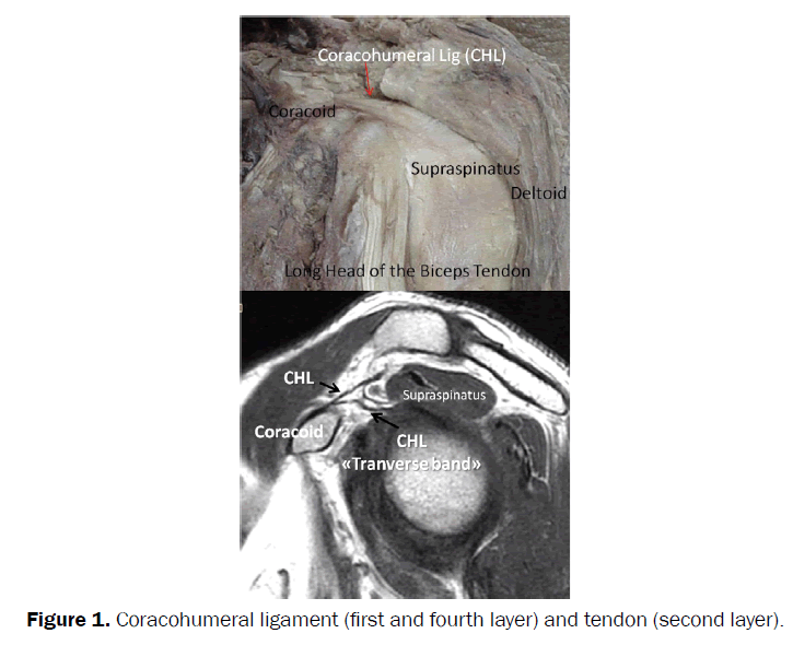 nursing-health-sciences-Coracohumeral-ligament