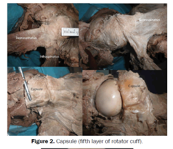 nursing-health-sciences-rotator-cuff