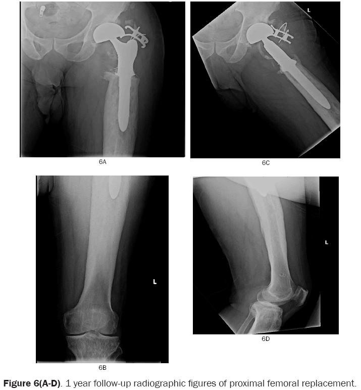 orthopedics-1-year-follow-up
