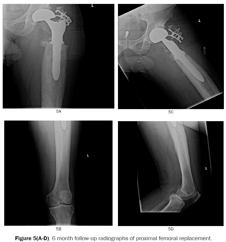 orthopedics-6-month-follow-up