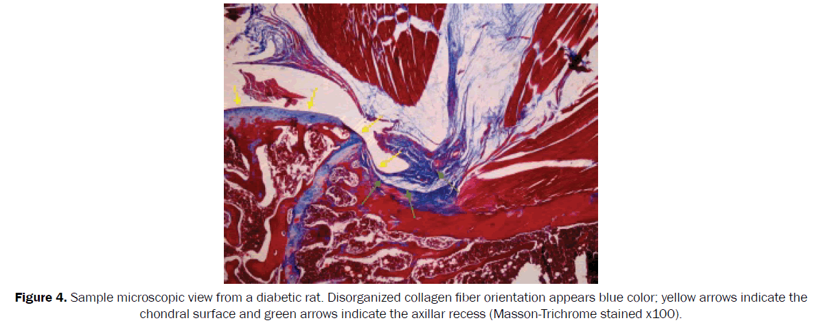 orthopedics-Disorganized-collagen