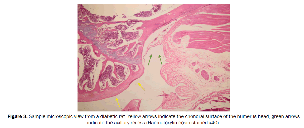 orthopedics-chondral-surface