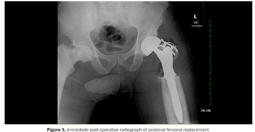 orthopedics-radiograph