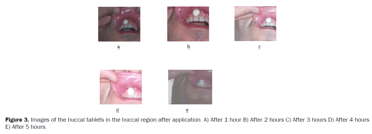 pharmaceutical-sciences-buccal-region