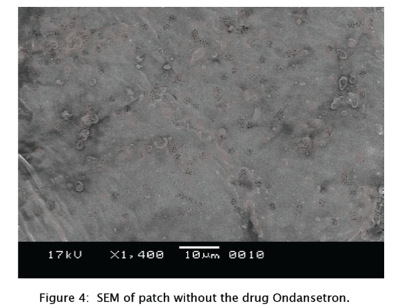 pharmaceutical-sciences-drug-Ondansetron