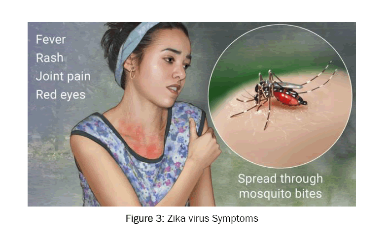 pharmacology-Toxicological-Studies-Zika-virus-Symptoms