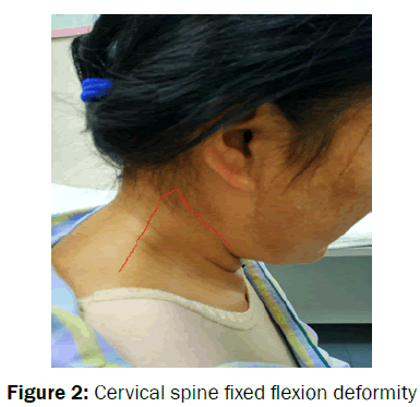 pharmacology-and-toxicological-studies-Cervical-spine-fixed