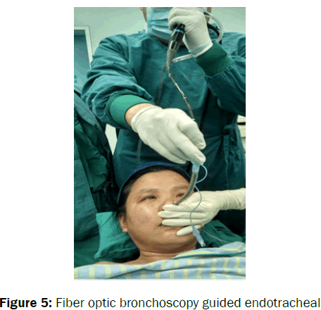 pharmacology-and-toxicological-studies-Fiber-optic-bronchoscopy