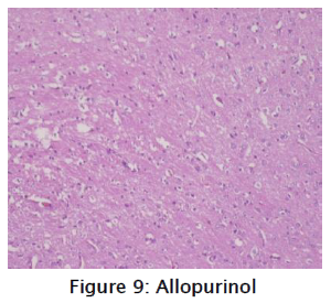 pharmacology-toxicological-studies-Allopurinol