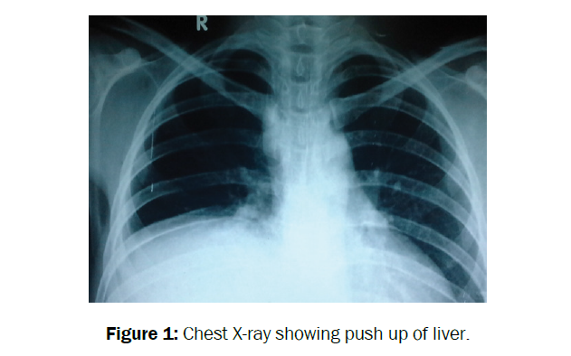 reports-cancer-treatments-chest-X-ray