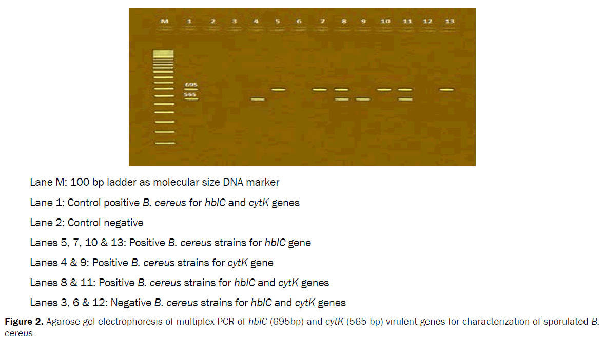 veterinary-sciences-Agarose-gel-electrophoresis