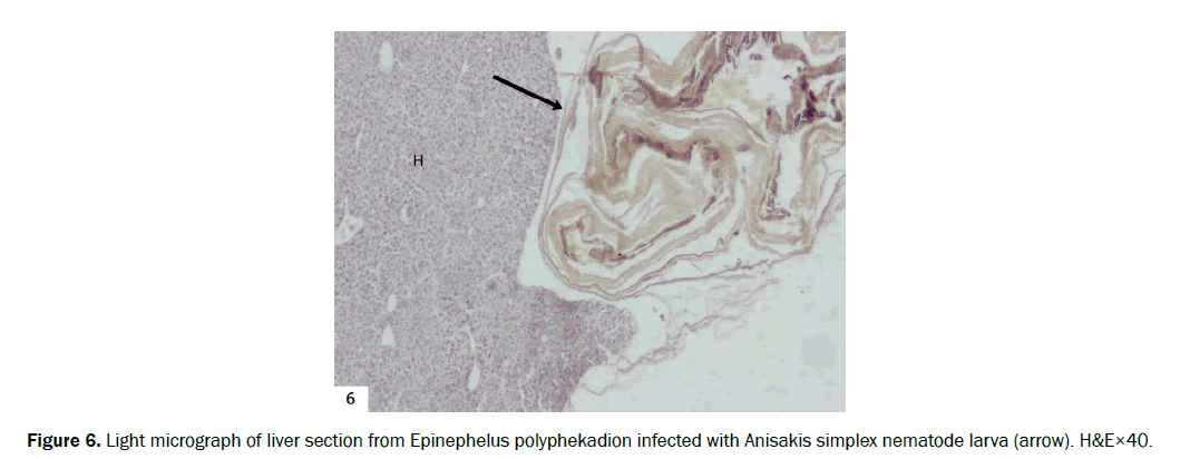 zoological-sciences-Anisakis-simplex-nematode