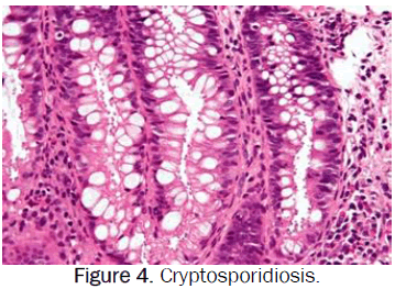 zoological-sciences-Toxoplasmosis-gondi