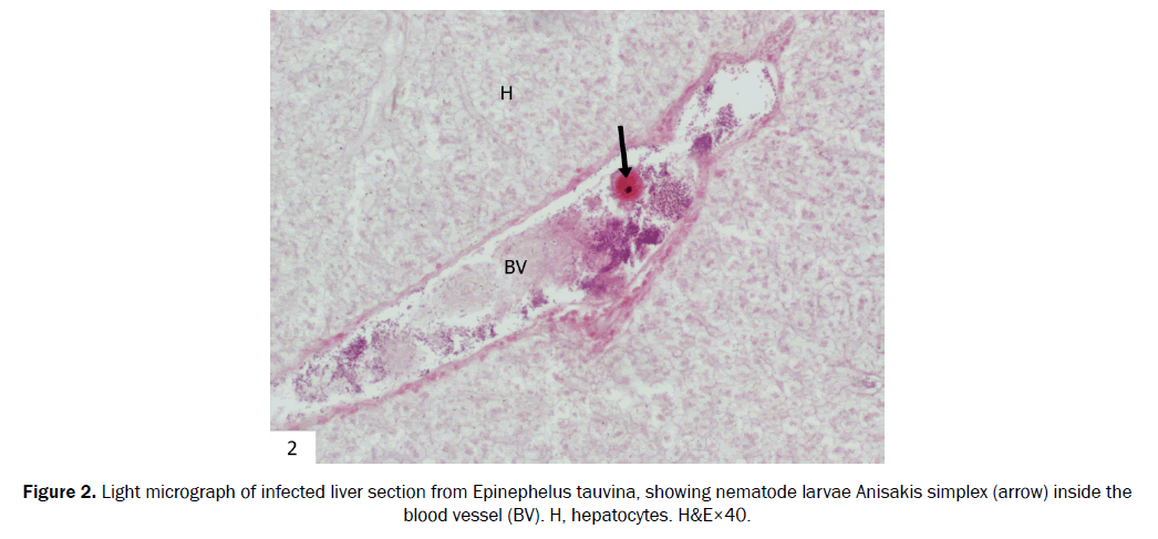 zoological-sciences-Light-micrograph-infected