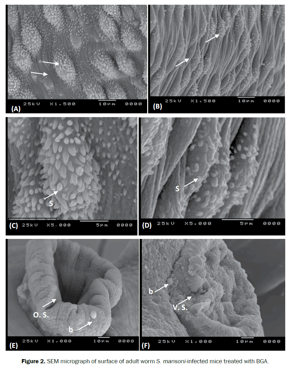 zoological-sciences-adult-worm